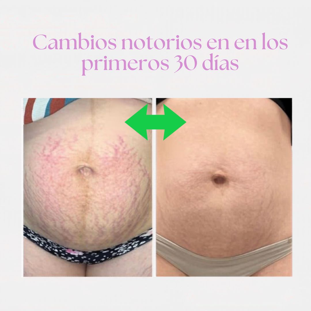 Crema reparadora quita- celulitis