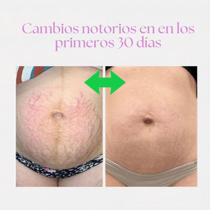 Crema reparadora quita- celulitis